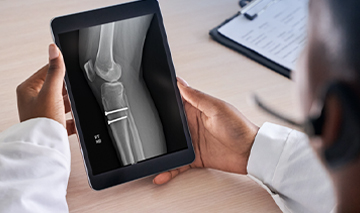 doctor reviewing x-ray on tablet