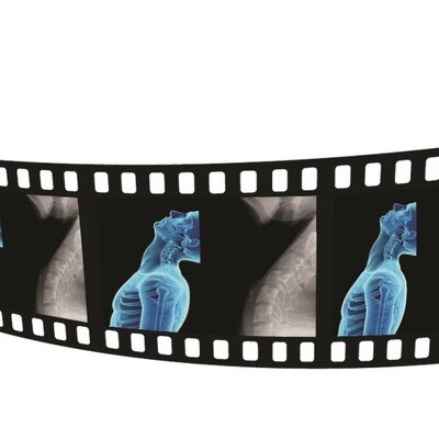 filmstrip of x-ray images