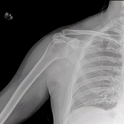 shoulder x-ray single frame from a DDR movie